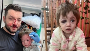 Yalova’da dehşet; Baba ve kızı darp edildi!