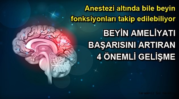 BEYİN AMELİYATI BAŞARISINI ARTIRAN 4 ÖNEMLİ GELİŞME