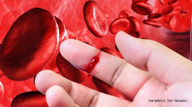  HEMOFİLİ HASTALARINA 7 ÖNEMLİ ÖNERİ