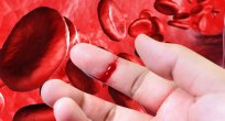  HEMOFİLİ HASTALARINA 7 ÖNEMLİ ÖNERİ
